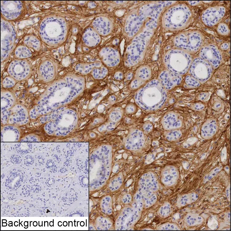 POSTN Mouse Monoclonal Antibody - Size: 100µl