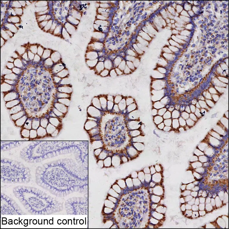 CLPP Mouse Monoclonal Antibody - Size: 50µl