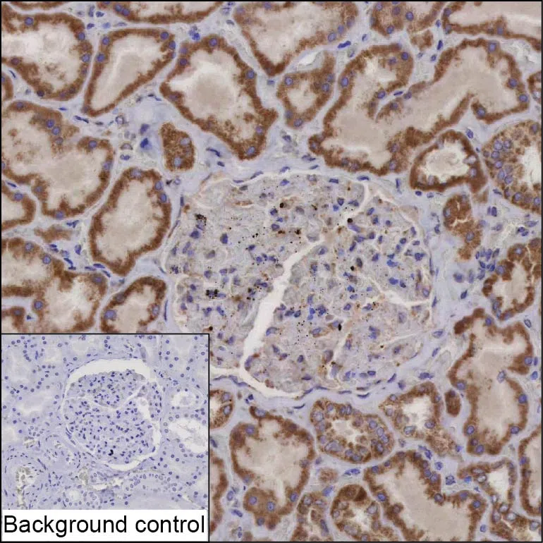ACAD9 Mouse Monoclonal Antibody - Size: 100µl
