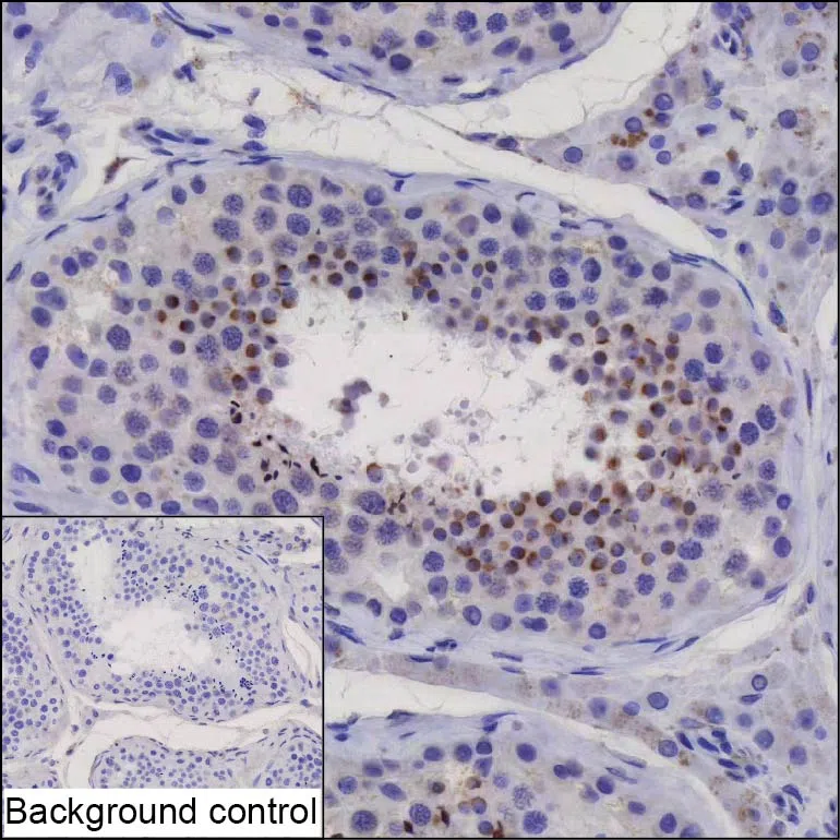 ANKRD26P1 Mouse Monoclonal Antibody - Size: 50µl