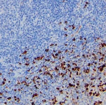 Human Lambda Mouse Monoclonal Antibody - Size: 100µl