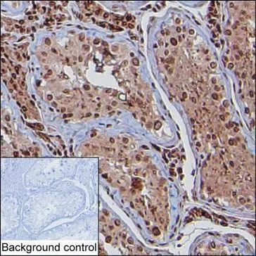 ID4 Mouse Monoclonal Antibody - Size: 100µl