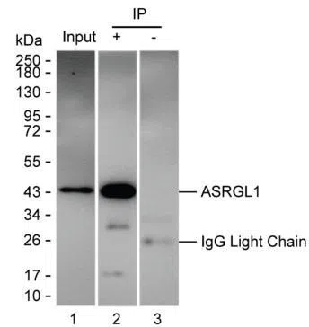ASRGL1 Mouse Monoclonal Antibody - Size: 100µl