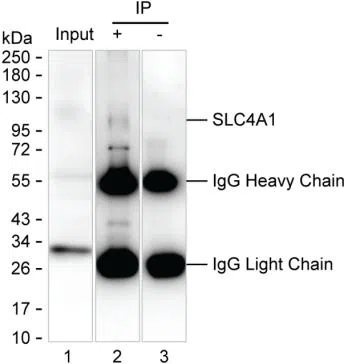 SLC4A1 Mouse Monoclonal Antibody - Size: 100µl