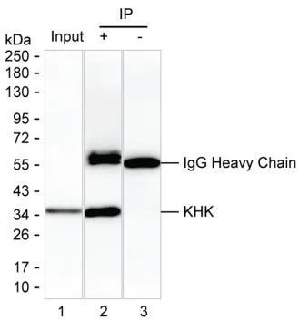 KHK Mouse Monoclonal Antibody - Size: 100µl