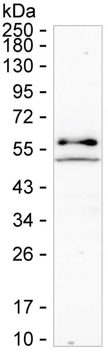 TXK Mouse Monoclonal Antibody - Size: 100µl