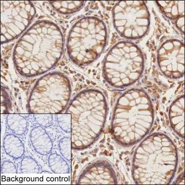MATN2 Mouse Monoclonal Antibody - Size: 50µl