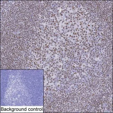 TOP2B Mouse Monoclonal Antibody - Size: 100µl