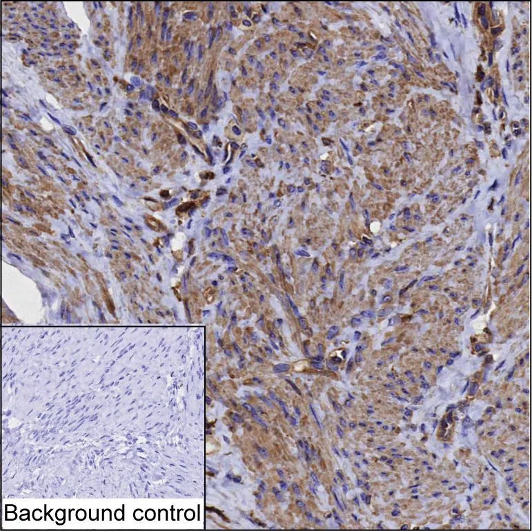 LAMA4 Mouse Monoclonal Antibody - Size: 100µl