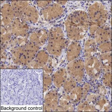 NADK Mouse Monoclonal Antibody - Size: 100µl