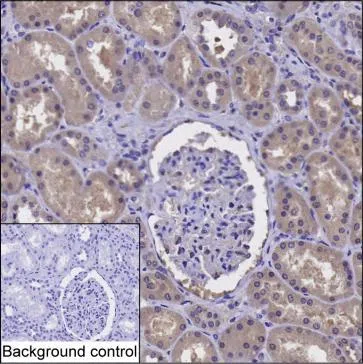 PPM1A Mouse Monoclonal Antibody - Size: 50µl