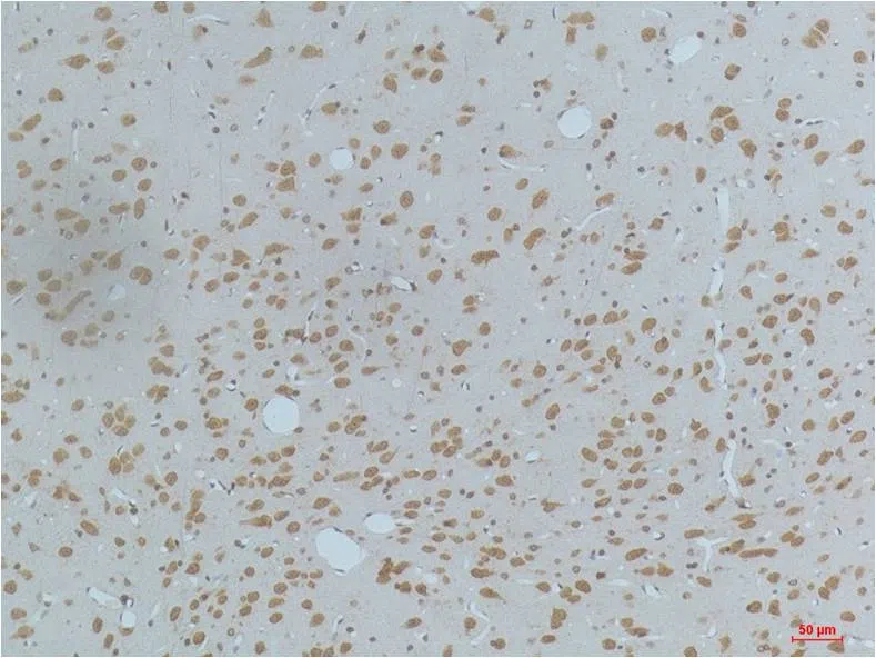 Phospho-CaMKII (Thr287) Mouse Monoclonal Antibody - Size: 100µl