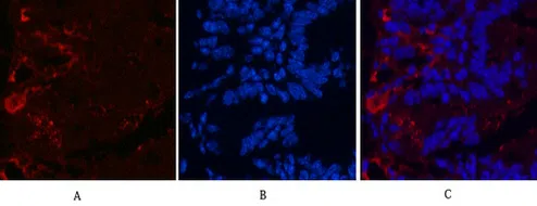 KIF7 Mouse Monoclonal Antibody - Size: 100µl