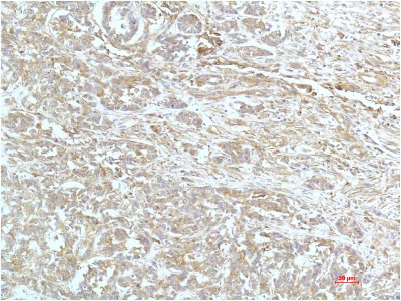 alpha Actinin Mouse Monoclonal Antibody - Size: 100µl