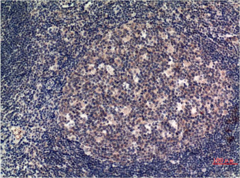 MLKL Mouse Monoclonal Antibody - Size: 100µl