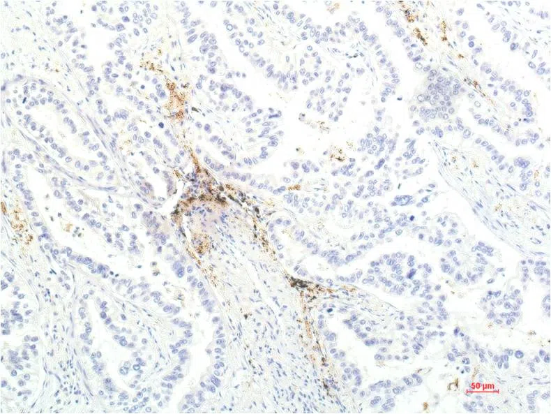 JAK1 Mouse Monoclonal Antibody - Size: 50µl