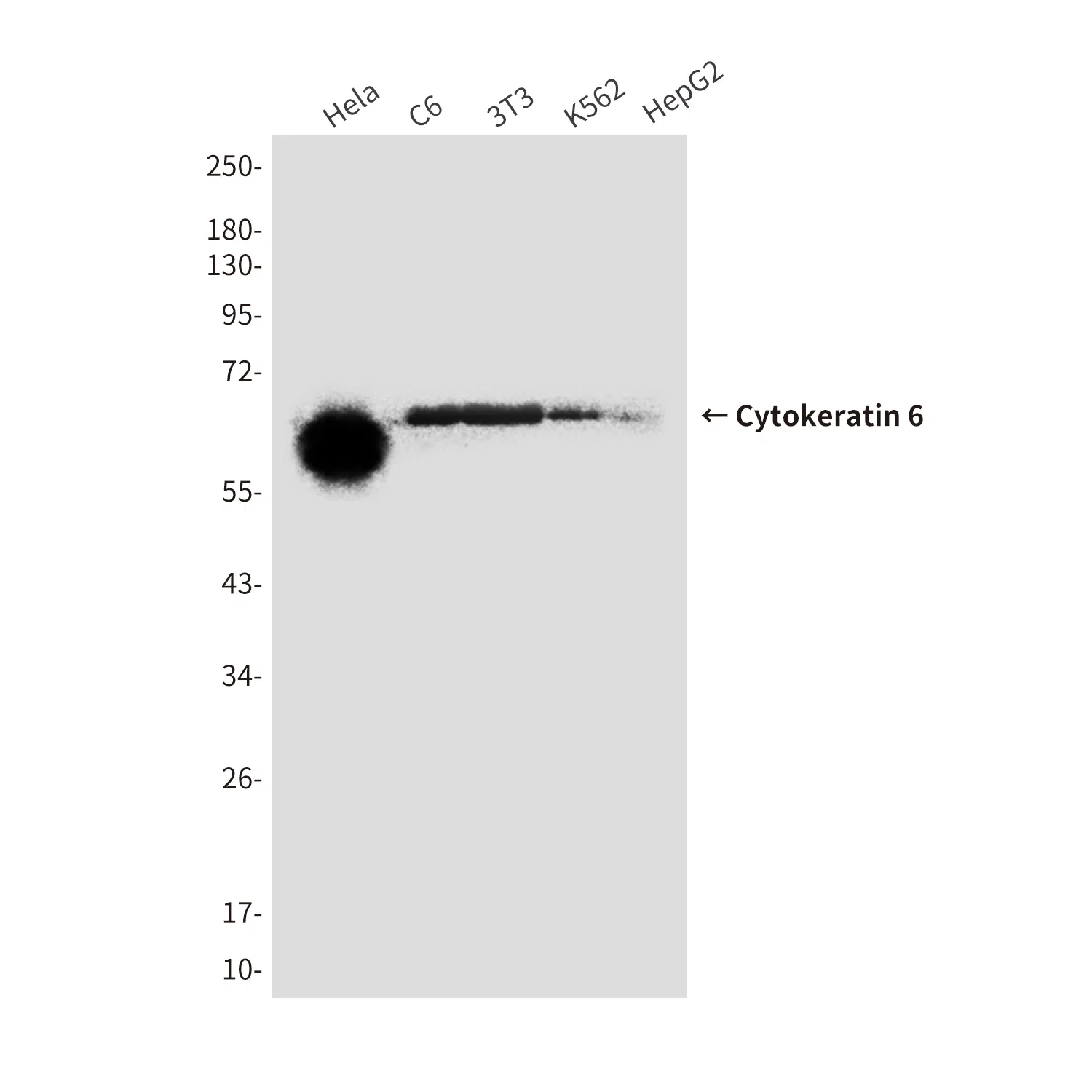 Cytokeratin 6 Mouse Monoclonal Antibody - Size: 50µl