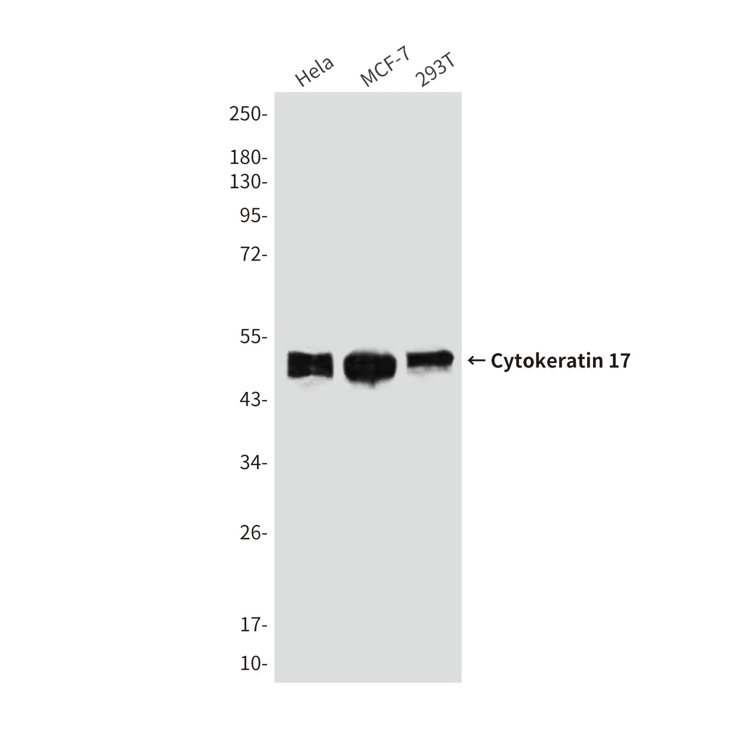 Cytokeratin 17 Mouse Monoclonal Antibody - Size: 100µl