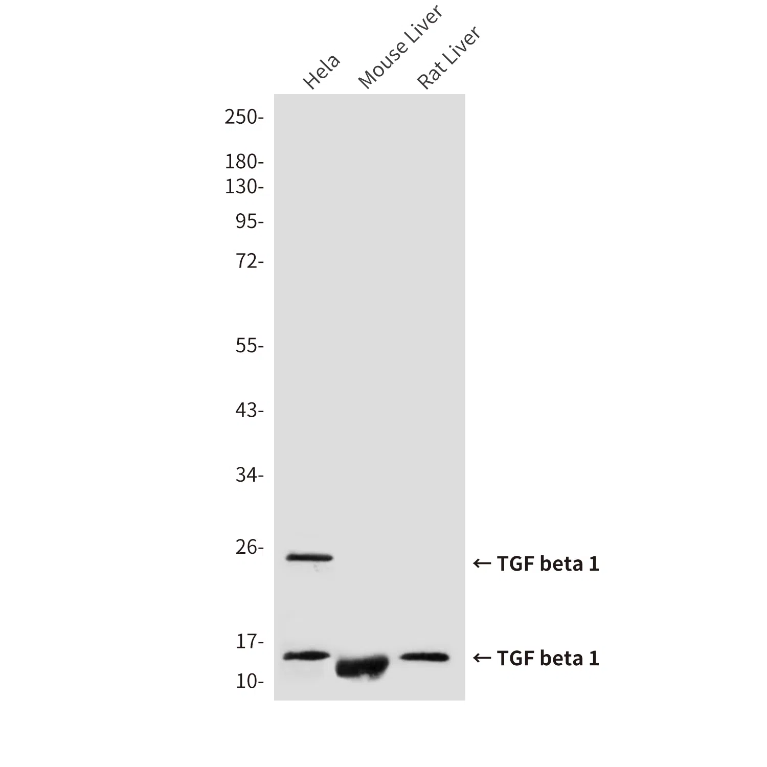 TGF beta 1 Mouse Monoclonal Antibody - Size: 50µl