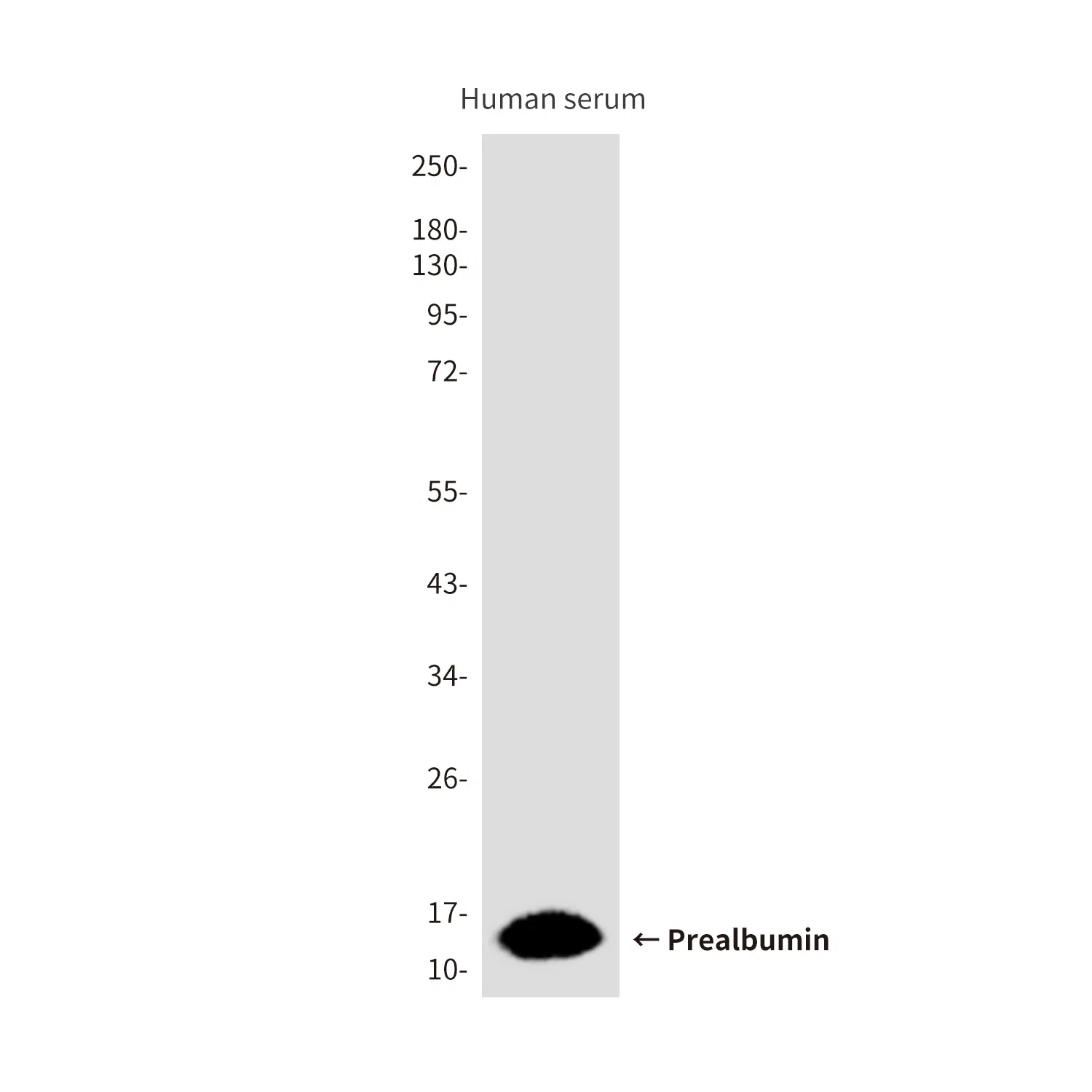 Prealbumin Mouse Monoclonal Antibody - Size: 100µl