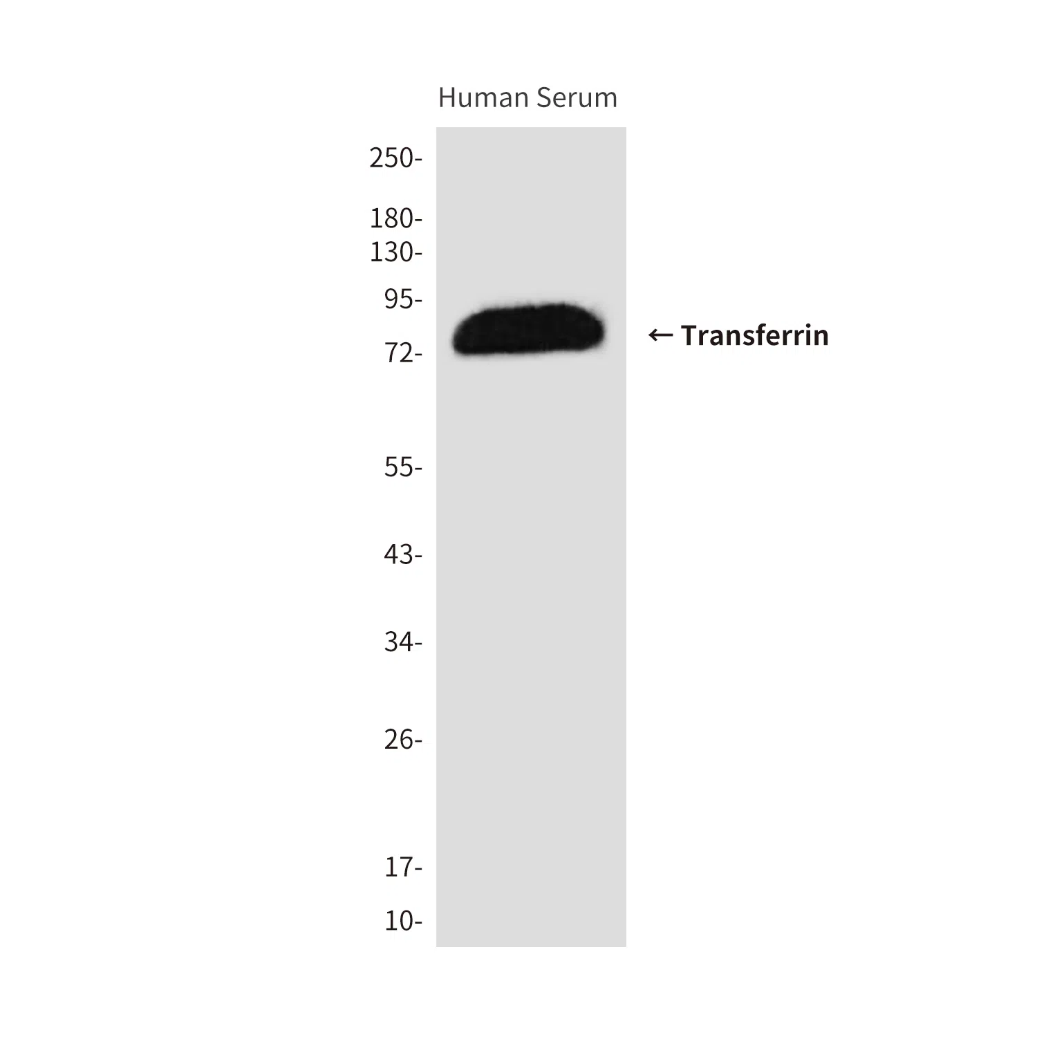 Transferrin Mouse Monoclonal Antibody - Size: 100µl