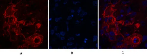 Carcino Embryonic Antigen CEA Mouse Monoclonal Antibody - Size: 100µl
