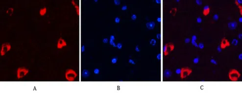 MAP2 Mouse Monoclonal Antibody - Size: 100µl
