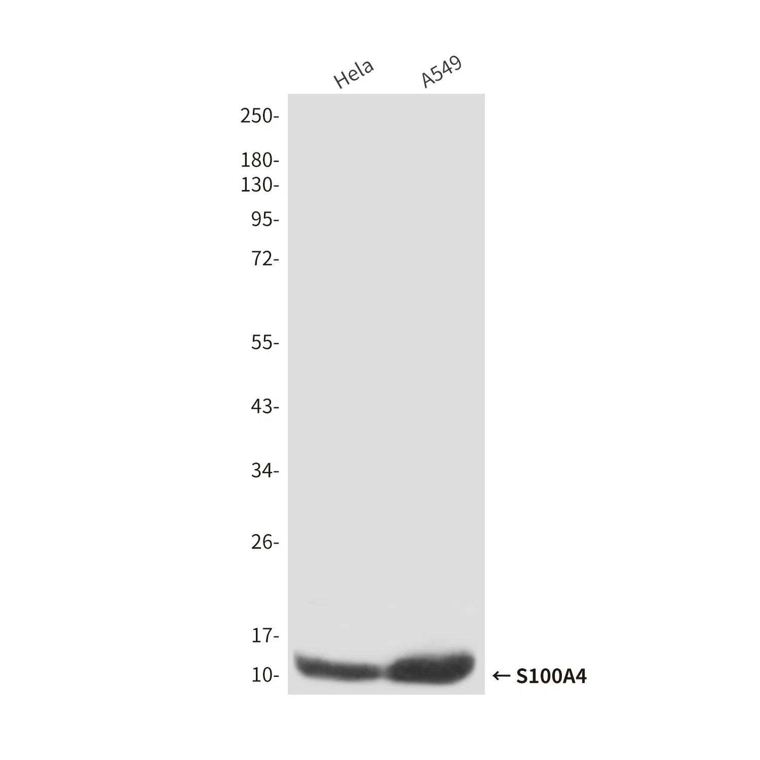 S100A4 Mouse Monoclonal Antibody - Size: 100µl