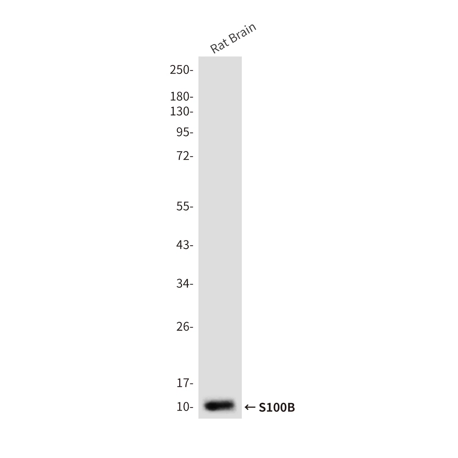 S100B Mouse Monoclonal Antibody - Size: 100µl