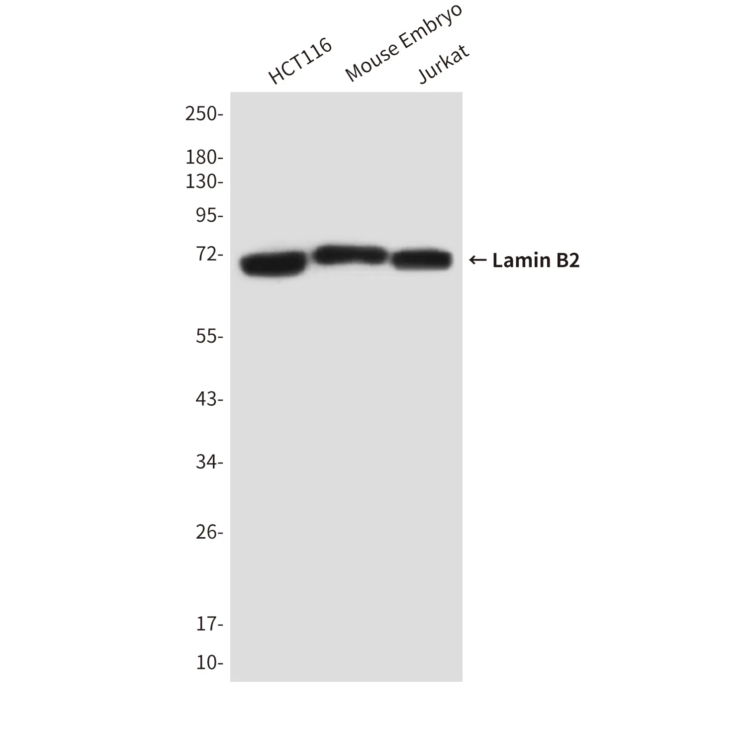 Lamin B2 Mouse Monoclonal Antibody - Size: 100µl