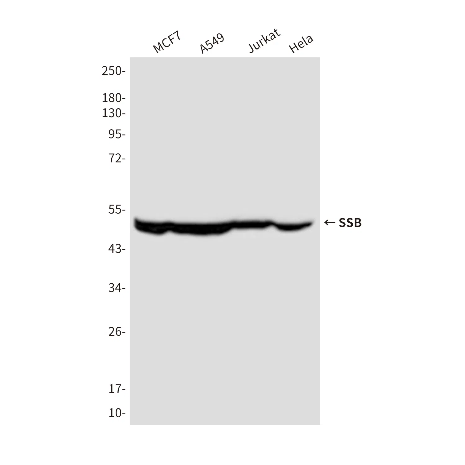 SSB Mouse Monoclonal Antibody - Size: 100µl