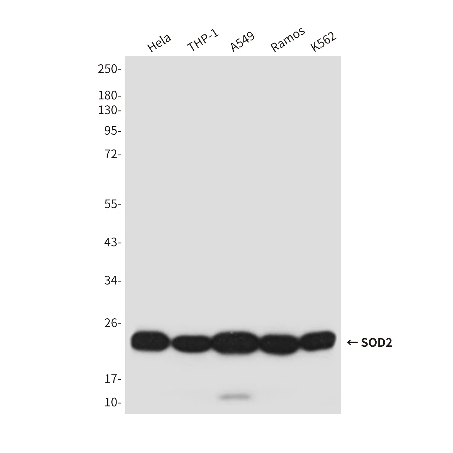 SOD2 Mouse Monoclonal Antibody - Size: 50µl