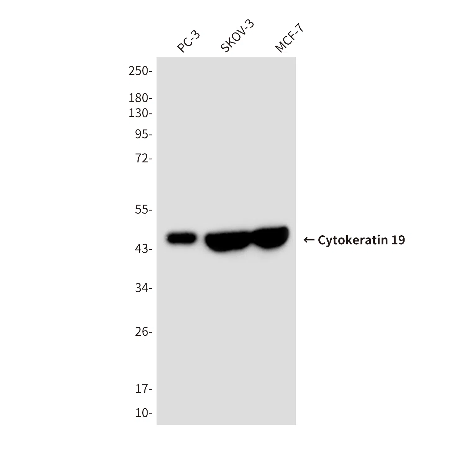 Cytokeratin 19 Mouse Monoclonal Antibody - Size: 100µl