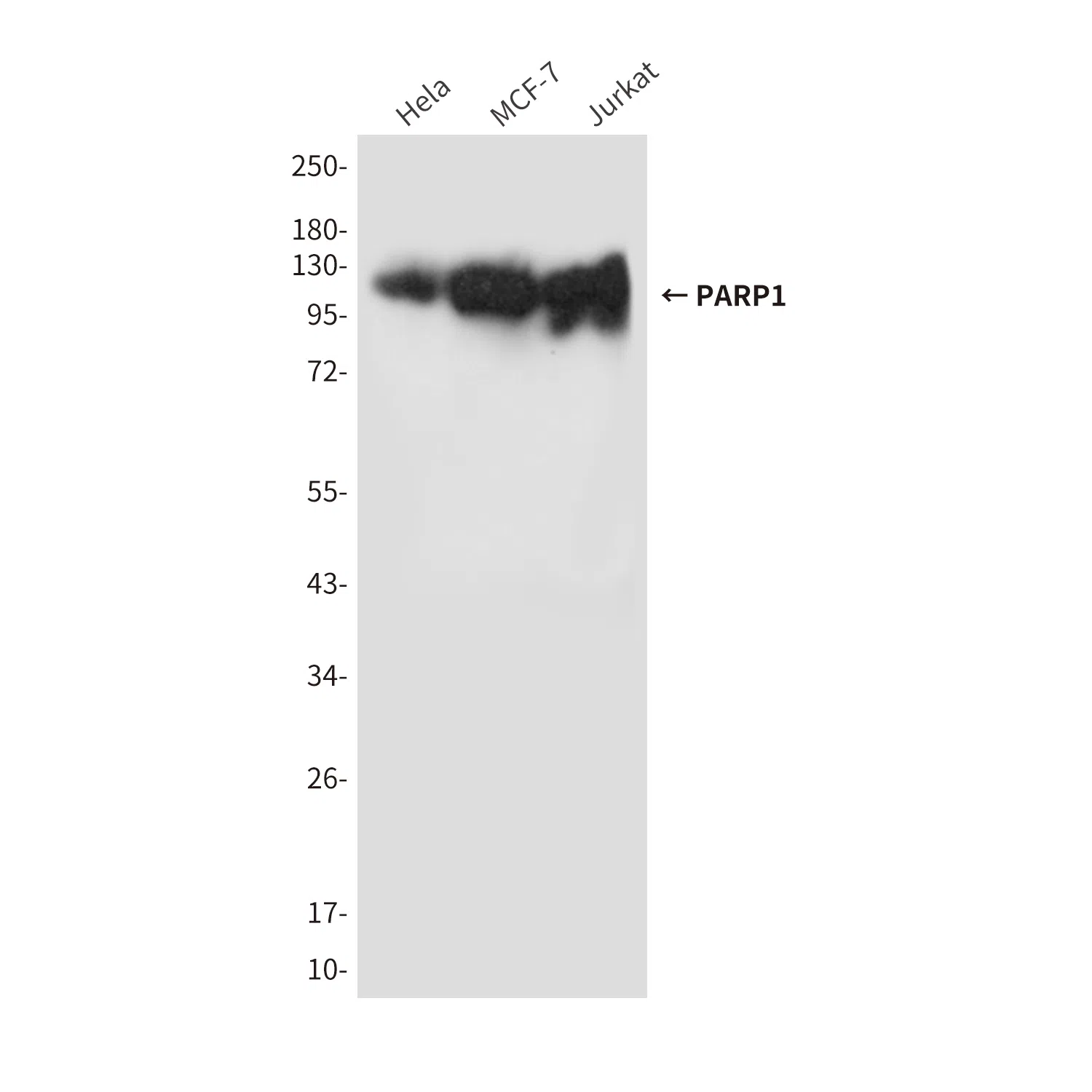 PARP1 Mouse Monoclonal Antibody - Size: 100µl