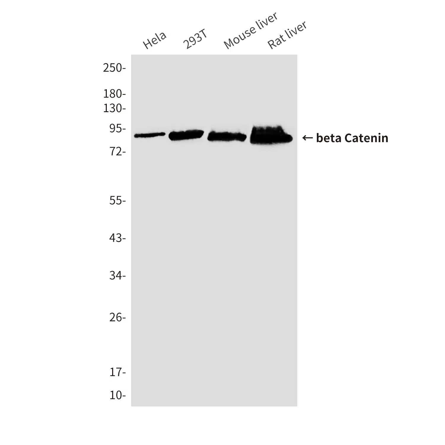 beta Catenin Mouse Monoclonal Antibody - Size: 50µl