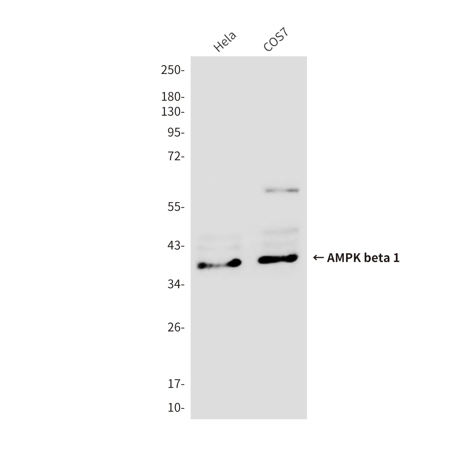 AMPK beta 1 Mouse Monoclonal Antibody - Size: 100µl