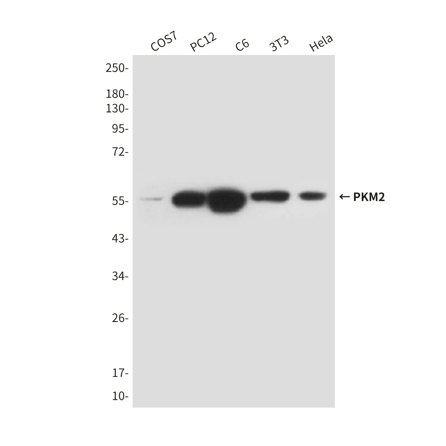 PKM2 Mouse Monoclonal Antibody - Size: 100µl