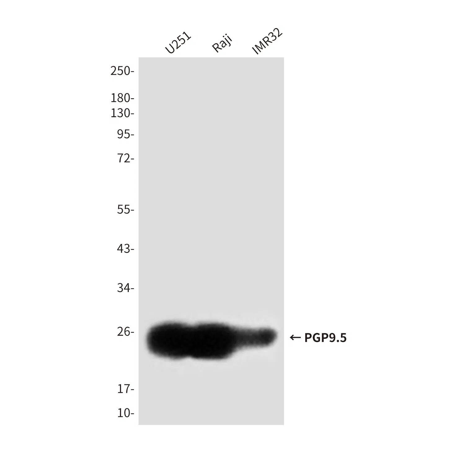 PGP9.5 Mouse Monoclonal Antibody - Size: 100µl