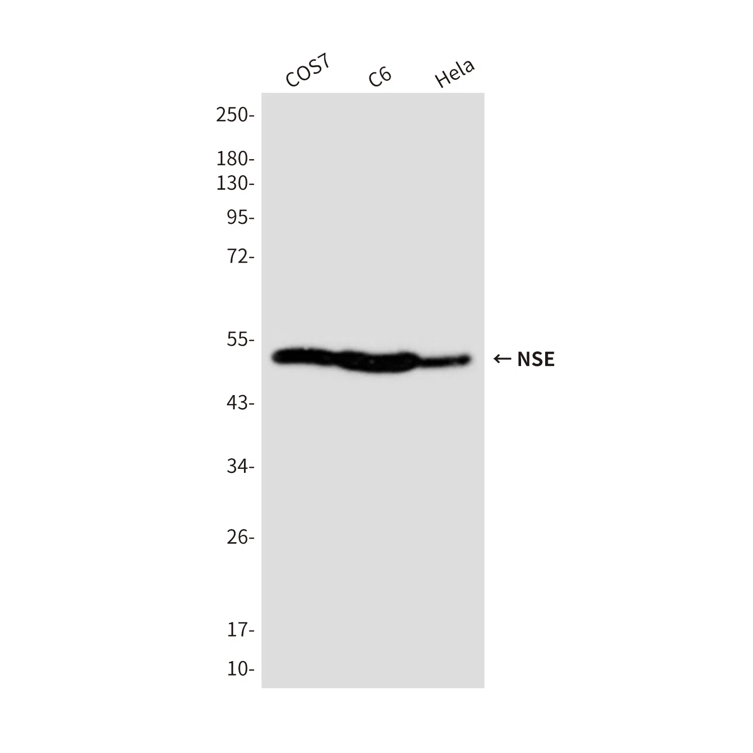 NSE Mouse Monoclonal Antibody - Size: 100µl