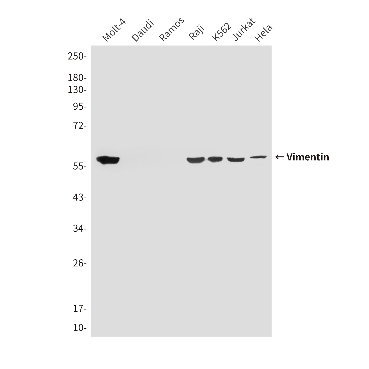 Vimentin Mouse Monoclonal Antibody - Size: 100µl