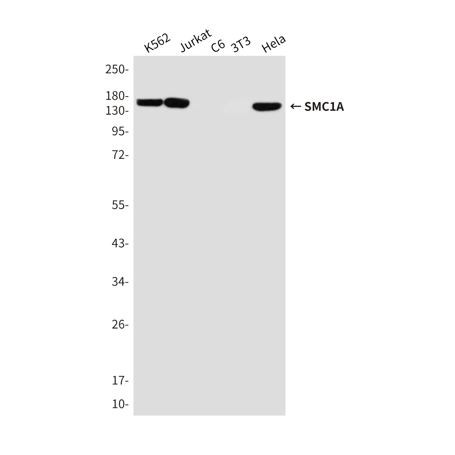SMC1A Mouse Monoclonal Antibody - Size: 50µl