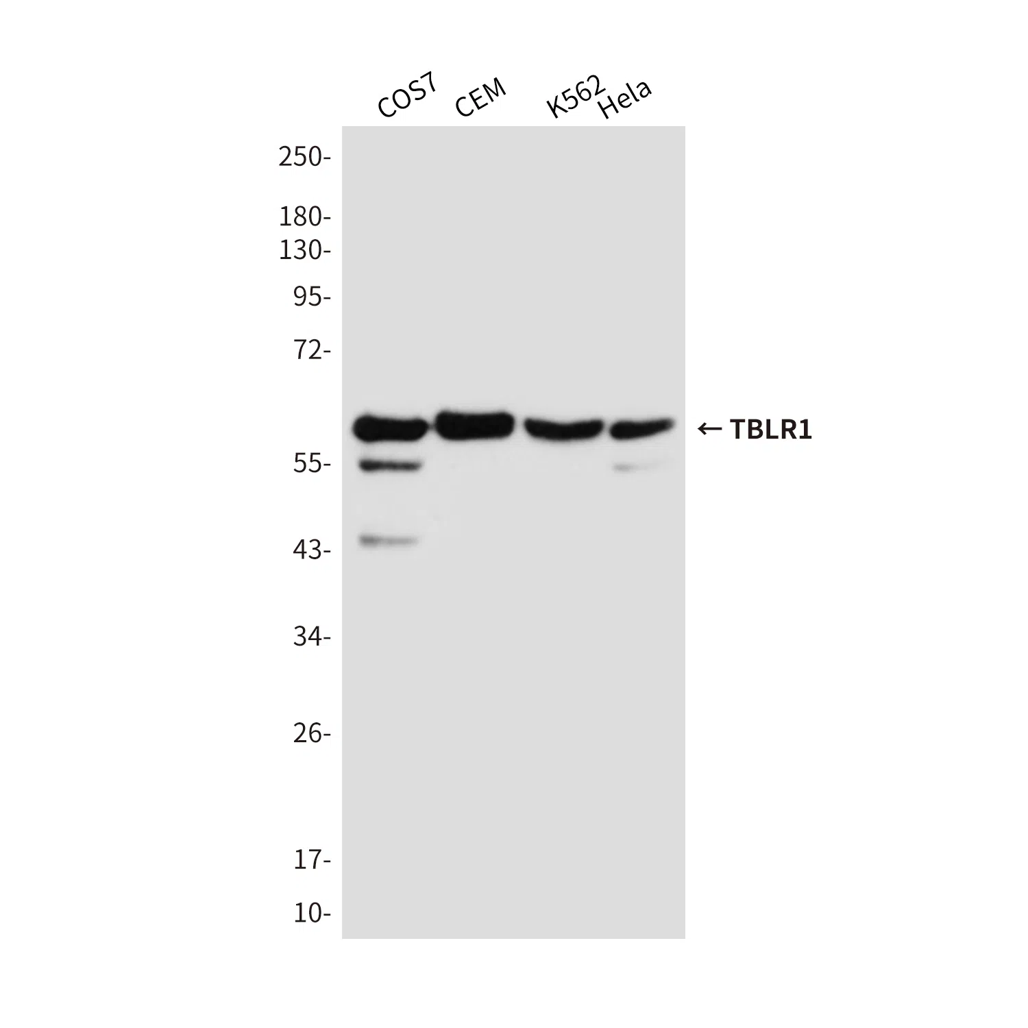 TBLR1 Mouse Monoclonal Antibody - Size: 100µl