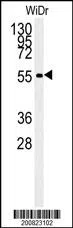 ALDH3A2 Mouse Monoclonal Antibody - Size: 100µl