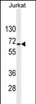 RPS6KB2 Mouse Monoclonal Antibody - Size: 50µl
