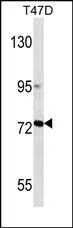 MMP2 Mouse Monoclonal Antibody - Size: 100µl