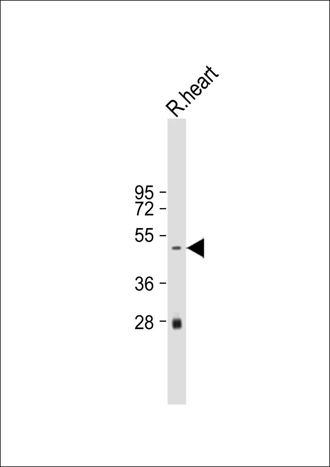 Rat Serpinh1 Mouse Monoclonal Antibody - Size: 50µl