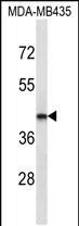 LHX2 Mouse Monoclonal Antibody - Size: 100µl