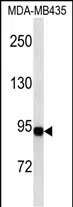 GSN (N-term) Mouse Monoclonal Antibody - Size: 100µl