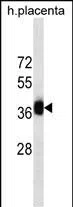 GBX2(Ascites) Mouse Monoclonal Antibody - Size: 100µl