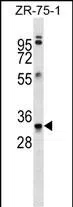 MBP Mouse Monoclonal Antibody - Size: 100µl